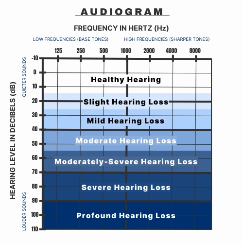 A graphic showing where the different levels of hearing loss are on an audiogram ranging from healthy to profound